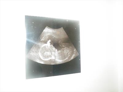 Mori Vivere II